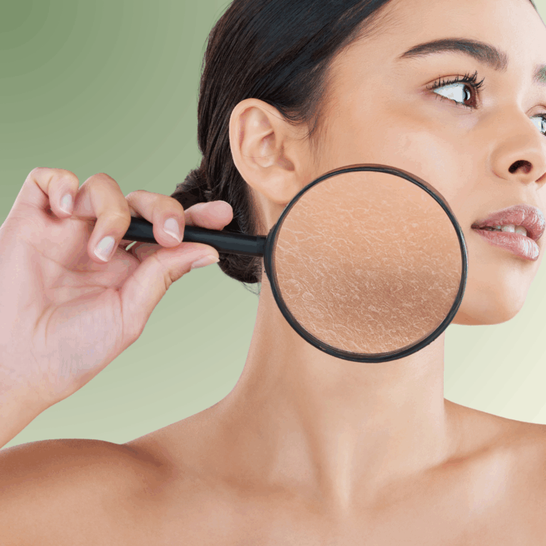 woman showing dry flaky skin on cheek with magnifying glass – dehydrated skin, tightness, rough texture